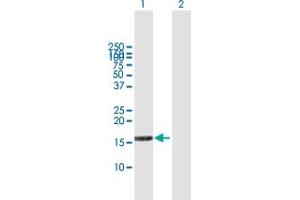 Western Blot analysis of DUSP22 expression in transfected 293T cell line by DUSP22 MaxPab polyclonal antibody. (DUSP22 antibody  (AA 1-184))