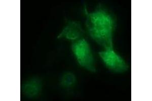 Image no. 2 for anti-Musashi Homolog 1 (Drosophila) (MSI1) antibody (ABIN1499574) (MSI1 antibody)