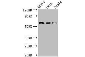 Western blot analysis of MCF-7 whole cell lysate, HeLa whole cell lysate and Mouse brain tissue, using SGO1 antibody (3 μg/ml) as the primary antibody and Goat anti-Rabbit polyclonal antibody (1/50000 dilution) as the secondary antibody.