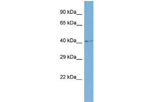 Host:  Rabbit  Target Name:  SLC6A5  Sample Type:  COLO205 Whole cell lysates  Antibody Dilution:  1. (SLC6A5 antibody  (N-Term))