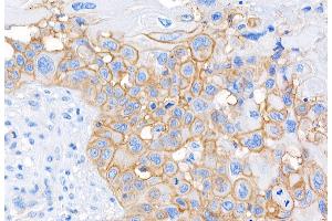 Immunohistochemistry (IHC) image for anti-CD44 (CD44) (AA 692-742) antibody (ABIN7453578) (CD44 antibody  (AA 692-742))