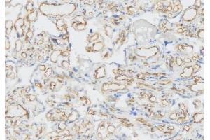 IHC analysis of VEGF Receptor 3 using anti-VEGF Receptor 3 antibody (ABIN5693136). (FLT4 antibody  (AA 25-259))