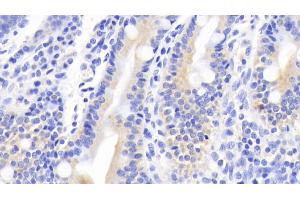 Detection of MUC5B in Human Small intestine Tissue using Polyclonal Antibody to Mucin 5 Subtype B (MUC5B) (MUC5B antibody  (AA 5366-5444))