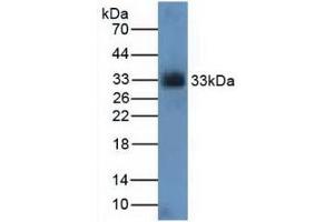 Figure. (CDK4 antibody  (AA 6-295))