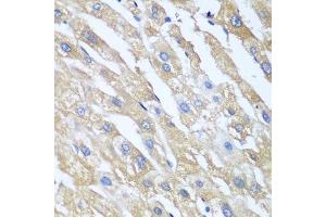 Immunohistochemistry of paraffin-embedded human liver using PPP4R1 antibody. (PPP4R1 antibody  (AA 324-647))