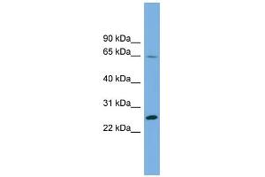 WB Suggested Anti-DHFRL1 Antibody Titration: 0. (DHFRL1 antibody  (Middle Region))