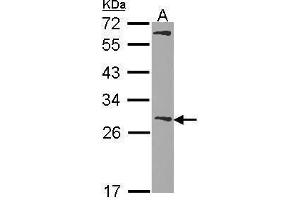 WB Image Sample (30 ug of whole cell lysate) A: Hela 12% SDS PAGE Glutathione S-transferase Mu 1 antibody antibody diluted at 1:1000
