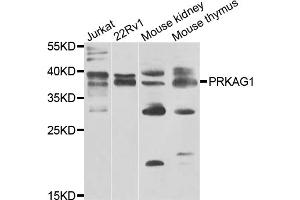 Western blot analysis of extracts of various cell lines, using PRKAG1 antibody. (PRKAG1 antibody)