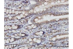 Image no. 1 for anti-Trans-Golgi Network Protein 2 (TGOLN2) (AA 229-328) antibody (ABIN599146) (TGOLN2 antibody  (AA 229-328))