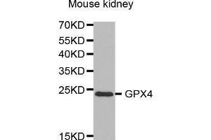 Western Blotting (WB) image for anti-Glutathione Peroxidase 4 (GPX4) (AA 30-197) antibody (ABIN6219078) (GPX4 antibody  (AA 30-197))