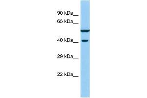Host: Rabbit Target Name: VWC2 Sample Type: Fetal Liver lysates Antibody Dilution: 1. (VWC2 antibody  (N-Term))