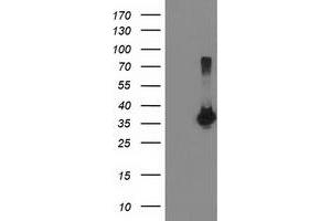 HEK293T cells were transfected with the pCMV6-ENTRY control (Left lane) or pCMV6-ENTRY LDLRAP1 (Right lane) cDNA for 48 hrs and lysed. (LDLRAP1 antibody)