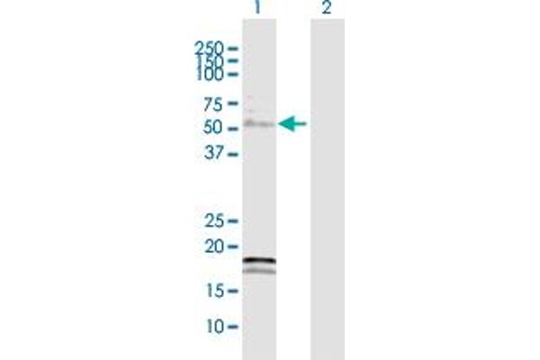 YBX2 anticorps  (AA 1-364)