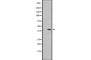 Western blot analysis of OR1I1 expression in MDA-MB231 cell line lysate ,The lane on the left is treated with the antigen-specific peptide. (OR1I1 antibody  (C-Term))