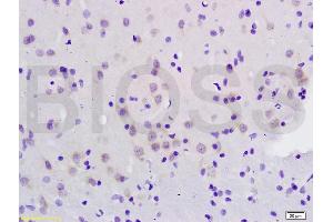 Formalin-fixed and paraffin embedded rat brain labeled with Anti-CXCL10 Polyclonal Antibody, Unconjugated (ABIN687442) at 1:200 followed by conjugation to the secondary antibody and DAB staining. (CXCL10 antibody  (AA 35-98))