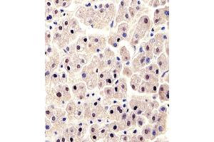 Immunohistochemical analysis of paraffin-embedded H. (ALT antibody  (N-Term))