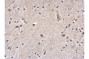 Immunohistochemistry (IHC) image for anti-H2A Histone Family, Member Z (H2AFZ) (C-Term) antibody (ABIN2856585)