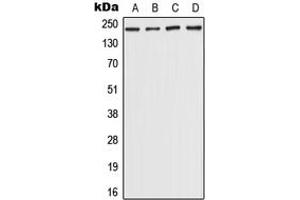 Western blot analysis of CHD5 expression in Hela (A), HepG2 (B), NIH3T3 (C), rat brain (D) whole cell lysates.