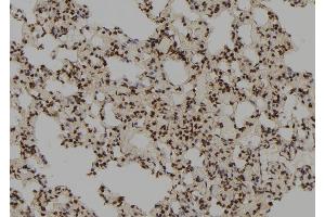 Immunohistochemistry (IHC) image for anti-Replication Factor C (Activator 1) 3, 38kDa (RFC3) (N-Term) antibody (ABIN6264710)