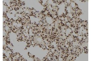 ABIN6278515 at 1/100 staining Rat lung tissue by IHC-P. (RFC3 antibody  (N-Term))