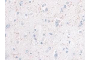 Detection of IL10 in Human Cerebrum Tissue using Monoclonal Antibody to Interleukin 10 (IL10) (IL-10 antibody  (AA 1-178))