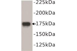Western Blotting (WB) image for anti-Epidermal Growth Factor Receptor (EGFR) (N-Term) antibody (ABIN1854890) (EGFR antibody  (N-Term))