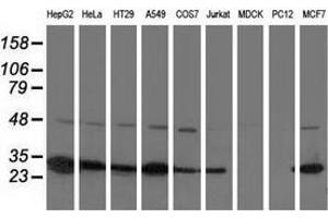 Western blot analysis of extracts (35 µg) from 9 different cell lines by using anti-SPR monoclonal antibody.