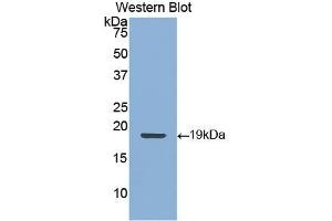 Detection of Recombinant KRT9, Human using Polyclonal Antibody to Cytokeratin 9 (CK9) (KRT9 antibody  (AA 315-456))
