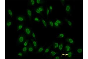 Immunofluorescence of monoclonal antibody to TAF11 on HeLa cell. (TAF11 antibody  (AA 158-210))