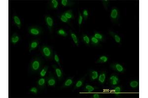 Immunofluorescence of monoclonal antibody to TAF11 on HeLa cell.