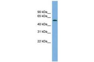 Image no. 1 for anti-Glucocorticoid Induced Transcript 1 (GLCCI1) (AA 179-228) antibody (ABIN6744984)