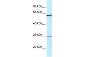 Image no. 1 for anti-Protein-tyrosine Phosphatase 1C (PTPN6) (AA 245-294) antibody (ABIN6747490) (SHP1 antibody  (AA 245-294))