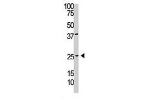 The PDGFB polyclonal antibody  is used in Western blot to detect PDGFC in A-375 cell lysate. (PDGFB antibody  (C-Term))