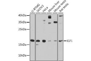 Western blot analysis of extracts of various cell lines, using IGF1 antibody (ABIN6134370, ABIN6142231, ABIN6142233 and ABIN6215544) at 1:3000 dilution. (IGF1 antibody  (AA 50-150))