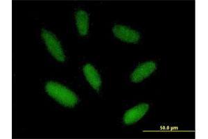 Immunofluorescence of purified MaxPab antibody to ZIM2 on HepG2 cell. (ZIM2 antibody  (AA 1-527))