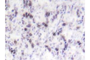 Immunohistochemistry analyzes of CREB antibody in paraffin-embedded human tonsil tissue. (CREB1 antibody)
