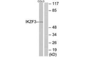 Western blot analysis of extracts from COLO cells, using IKZF3 Antibody. (IKZF3 antibody  (AA 361-410))