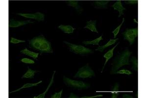 Immunofluorescence of monoclonal antibody to SFN on HeLa cell. (14-3-3 sigma/SFN antibody  (AA 1-248))