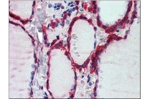 Immunohistochemistry: Human Thyroid: Formalin-Fixed, Paraffin-Embedded (FFPE) (Peroxiredoxin 1 antibody  (Internal Region))