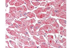 Human Heart: Formalin-Fixed, Paraffin-Embedded (FFPE). (Ataxin 3 antibody  (AA 35-84))