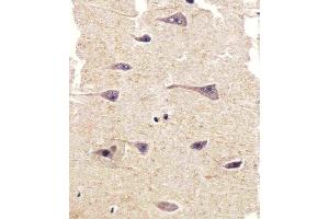 Immunohistochemical analysis of paraffin-embedded H. (PTK2B antibody  (C-Term))