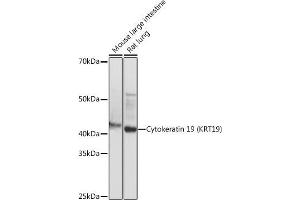 Western blot analysis of extracts of various cell lines, using Cytokeratin 19 (KRT19) (KRT19) antibody (ABIN7268099) at 1:1000 dilution. (Cytokeratin 19 antibody)