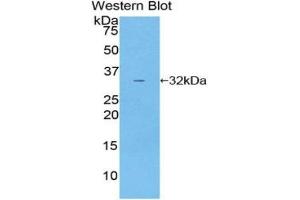 Western blot analysis of the recombinant protein.