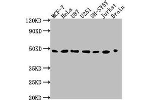 Western Blot Positive WB detected in: MCF-7 whole cell lysate, HeLa whole cell lysate, U87 whole cell lysate, U251 whole cell lysate, SH-SY5Y whole cell lysate, Jurkat whole cell lysate, Rat brain tissue All lanes: LOX antibody at 1:2000 Secondary Goat polyclonal to rabbit IgG at 1/50000 dilution Predicted band size: 47 kDa Observed band size: 47 kDa (LOX antibody  (AA 23-285))
