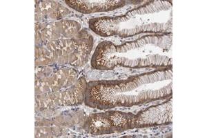Immunohistochemical staining of human stomach with FBXO43 polyclonal antibody  shows distinct cytoplasmic positivity in glandular cells. (FBXO43 antibody)