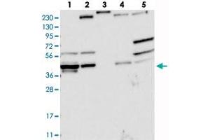 Western blot analysis of Lane 1: RT-4, Lane 2: U-251 MG, Lane 3: Human Plasma, Lane 4: Liver, Lane 5: Tonsil with AGPAT9 polyclonal antibody . (AGPAT9 antibody)