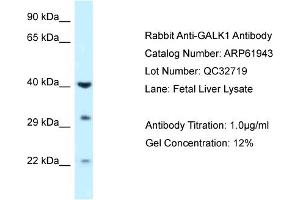 Western Blotting (WB) image for anti-Galactokinase 1 (GALK1) (C-Term) antibody (ABIN2788956) (GALK1 antibody  (C-Term))