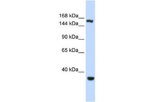 Western Blotting (WB) image for anti-Eukaryotic Translation Initiation Factor 4 gamma 3 (EIF4G3) antibody (ABIN2458505) (EIF4G3 antibody)