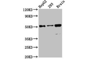Western Blot Positive WB detected in: HepG2 whole cell lysate, 293 whole cell lysate, Mouse brain tissue All lanes: ZFP57 antibody at 13. (ZFP57 antibody  (AA 183-295))