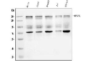 Western blot analysis of WAPL/FOE using anti-WAPL/FOE antibody (ABIN7602663).